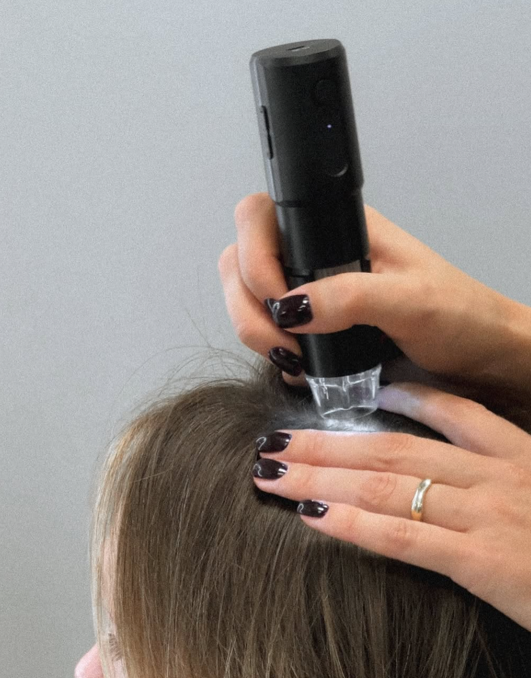 Hair & Scalp Diagnostics & 50€ Gift Card